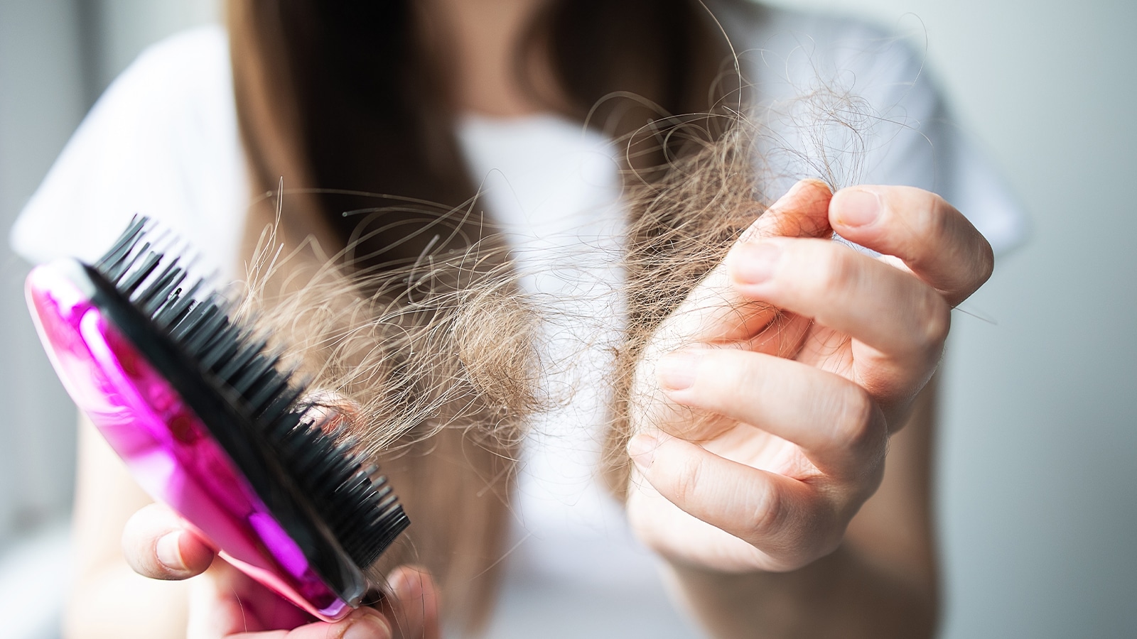 Does Stress Cause Hair Loss